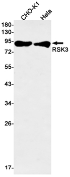 RSK3 Rabbit mAb