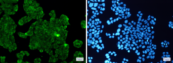 PP1C beta Rabbit mAb