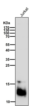Secretory Phospholipase A2 Rabbit mAb