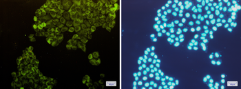 Fructose 6 Phosphate Kinase Rabbit mAb