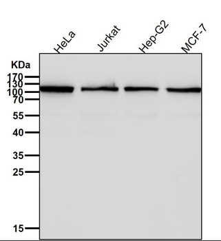 NF kappa B p100 Rabbit mAb