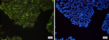 NF kappa B p100 Rabbit mAb