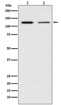 NF kappa B p100 Rabbit mAb