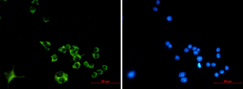 Cathepsin B Rabbit mAb