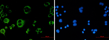 Catalase Rabbit mAb