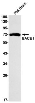 BACE1 Rabbit mAb Antibody