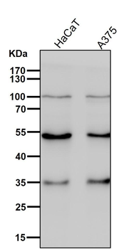 Activin A Receptor Type IB Rabbit mAb