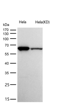 HRPT2 / CDC73 Rabbit mAb [KD Validated] Antibody
