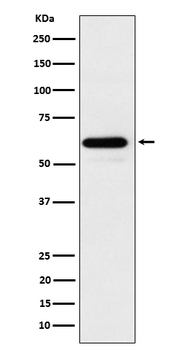 HRPT2 / CDC73 Rabbit mAb [KD Validated] Antibody