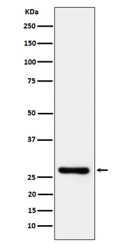 DcR1 / CD263 Rabbit mAb Antibody