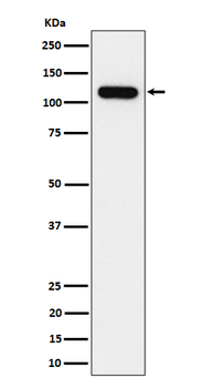 NOLC1 Rabbit Monoclonal Antibody