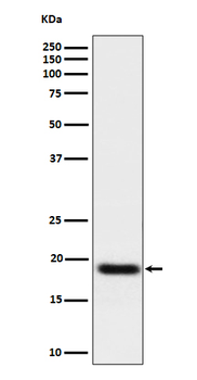 TNFAIP8 Rabbit mAb Antibody