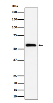 PNK/PNKP Rabbit Monoclonal Antibody