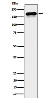 CLIP170 Rabbit mAb [KD Validated] Antibody