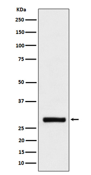 BRMS1 Rabbit mAb [KD Validated] Antibody