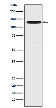 CC2D1A Rabbit mAb [KD Validated] Antibody