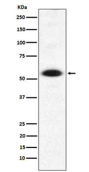 DMAP1 Rabbit Monoclonal Antibody