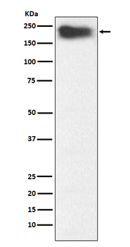 MYH7B Rabbit Monoclonal Antibody