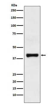 GOT2 Rabbit Monoclonal Antibody