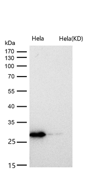 CHMP2B Rabbit Monoclonal Antibody