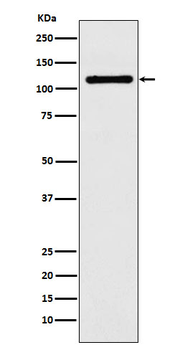 DPYD Rabbit Monoclonal Antibody