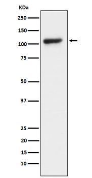 KDM1/LSD1 Rabbit Monoclonal Antibody