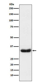 LEFTY1 + LEFTY2 Rabbit mAb Antibody