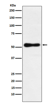 ROR beta Rabbit Monoclonal Antibody