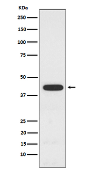 PCYT1A Rabbit mAb Antibody