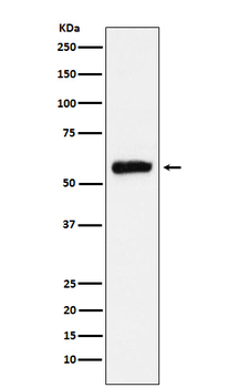 ALDH2 Rabbit Monoclonal Antibody