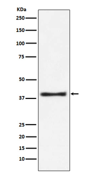 Aspartate Aminotransferase Rabbit Monoclonal Antibody