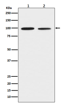 DDR2 Rabbit Monoclonal Antibody