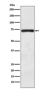 BACE1 Rabbit mAb Antibody