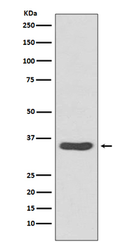 CDCA5 Rabbit mAb Antibody