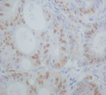 Cyclin A1/A2 Rabbit mAb [KD Validated] Antibody