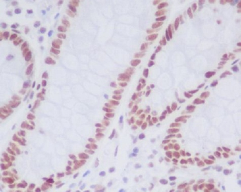 KDM1/LSD1 Rabbit Monoclonal Antibody