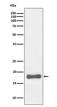 PUMA Rabbit mAb Antibody