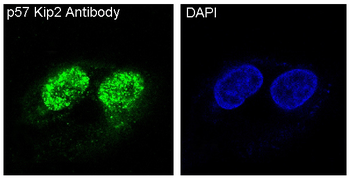 p57 Kip2 Rabbit Monoclonal Antibody