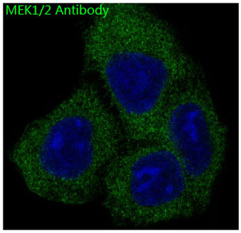MEK1/2 Rabbit mAb Antibody