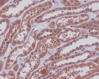 MEK1/2 Rabbit mAb Antibody