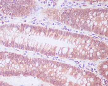 ENO1 Rabbit Monoclonal Antibody