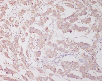 Beclin 1 Rabbit Monoclonal Antibody