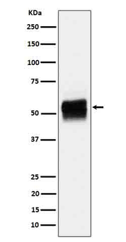 Tau (Phospho-Ser202) Rabbit mAb Antibody