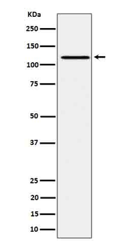 JAK1 (Phospho-Tyr1034/Tyr1035) Rabbit mAb