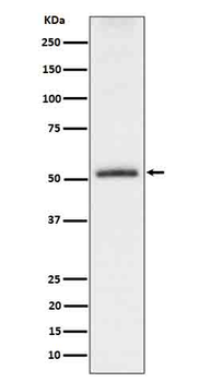 Tau (Phospho-Ser198) Rabbit mAb Antibody