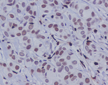 c-Jun (Phospho-Ser63) Rabbit mAb Antibody