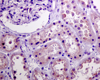 Akt(Phospho-Ser473) Rabbit mAb Antibody