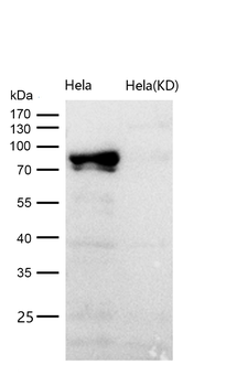 STAT3 (Phospho-Tyr705) Rabbit mAb [KD Validated] Antibody