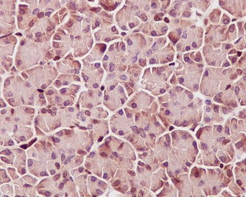 STAT3 (Phospho-Tyr705) Rabbit mAb [KD Validated] Antibody