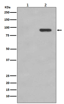 beta Catenin (Phospho-Ser33/Ser37) Rabbit mAb Antibody